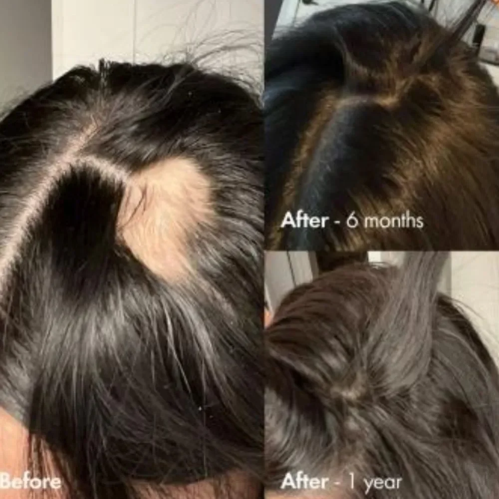 BondiBoost‎ Grow Getter Haircare Kit For Thinning Hair